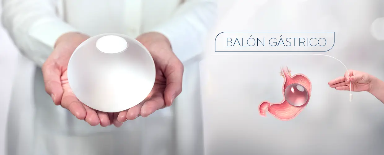 Gastric Balloon in Colombia
