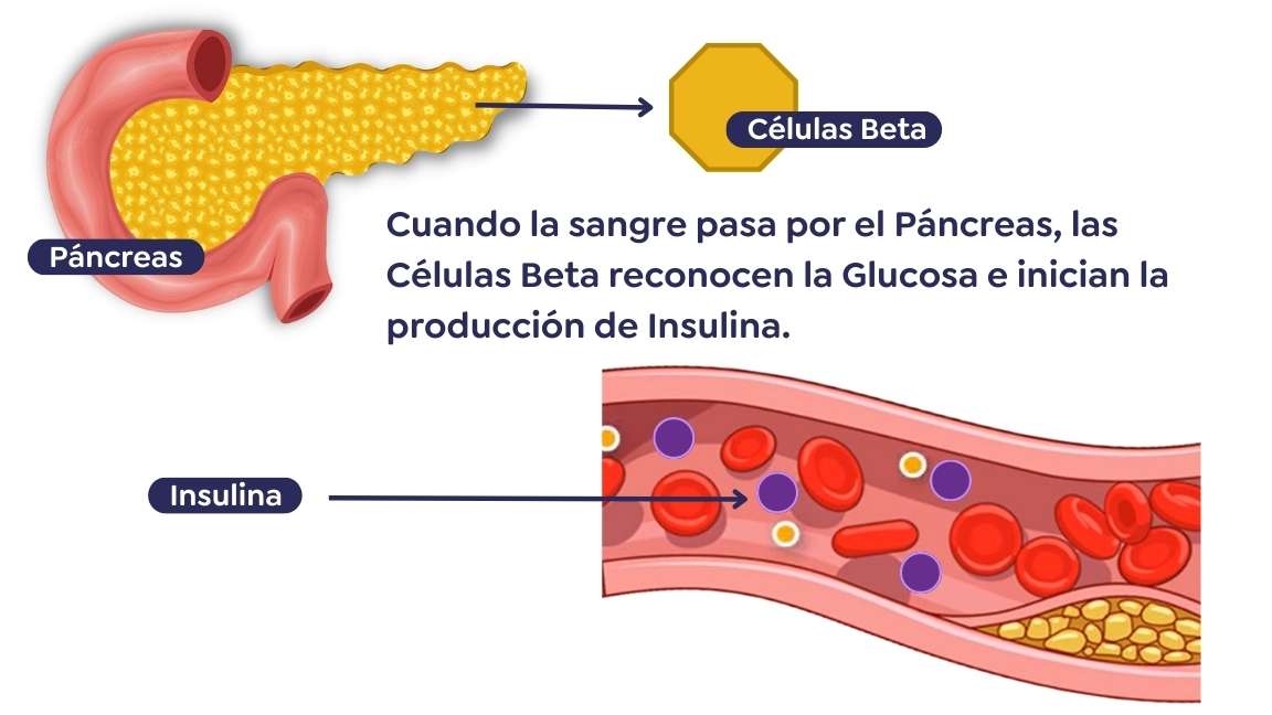 ¿Qué es Diabetes tipo 2? - Dr. Ruben Luna