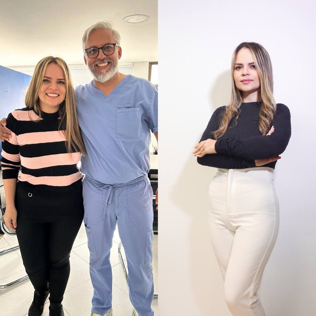 Antes y Después de Cirugía Bariátrica - Dr Rubén Luna Cirujano Bariátrico en Bogotá -ALT