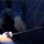 Entendiendo los criterios para elegir una cirugía bariátrica