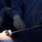Criterios para cirugía bariátrica