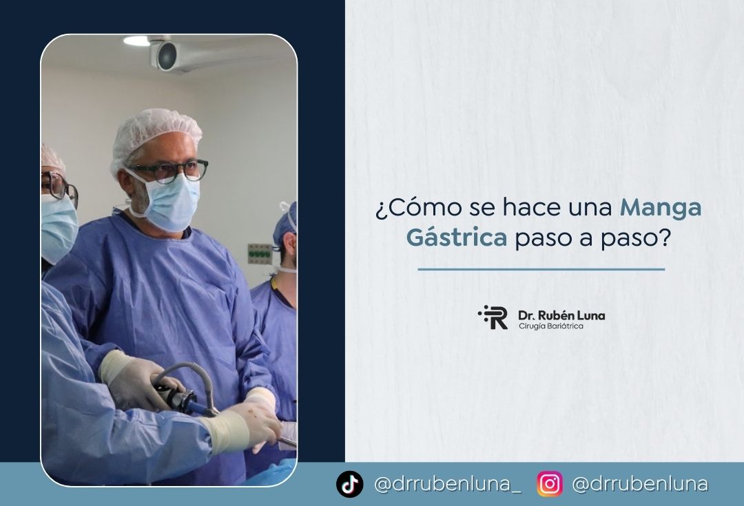 Dr. Rubén Luna explica cómo se hace una manga gástrica en Colombia