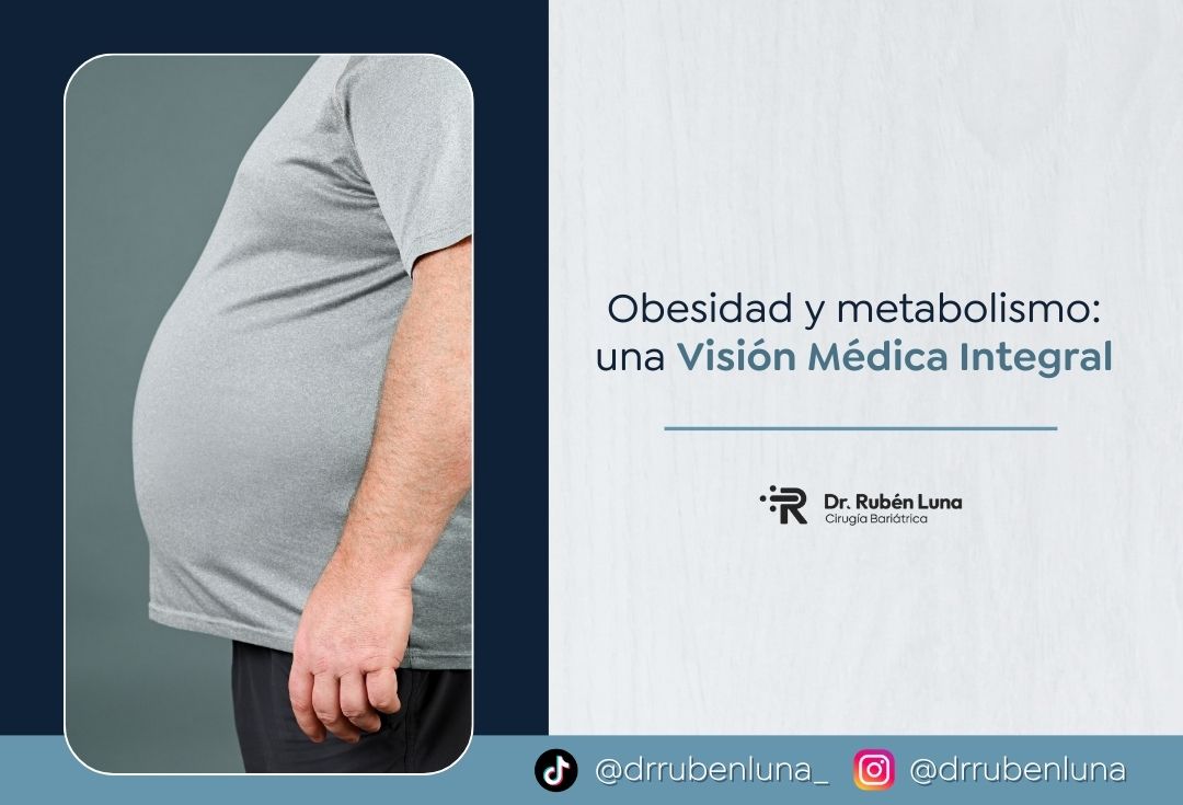 Obesidad y metabolismo- Dr. Rubén Luna-Cirujano bariátrico