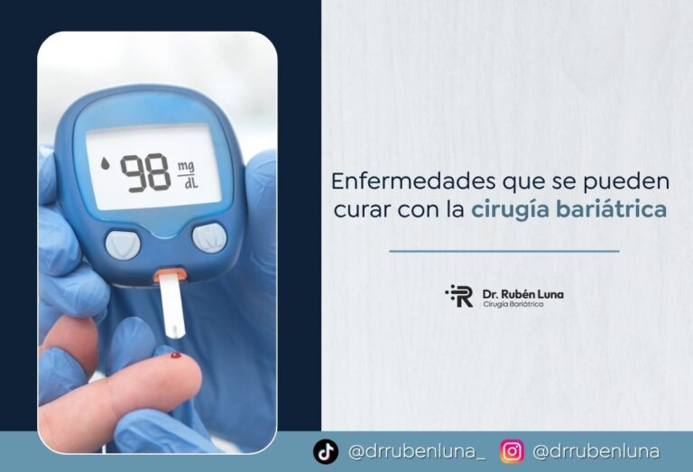 Comorbilidades que trata la cirugía bariátrica - Dr. Rubén Luna