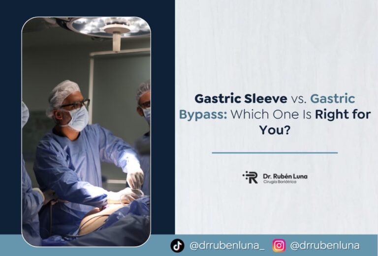 gastric sleeve vs bypass-Dr. Rubén Luna