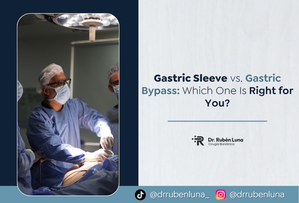 gastric sleeve vs bypass-Dr. Rubén Luna