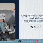Cirugía bariátrica robótica de tres incisiones explicada por el Dr. Rubén Luna