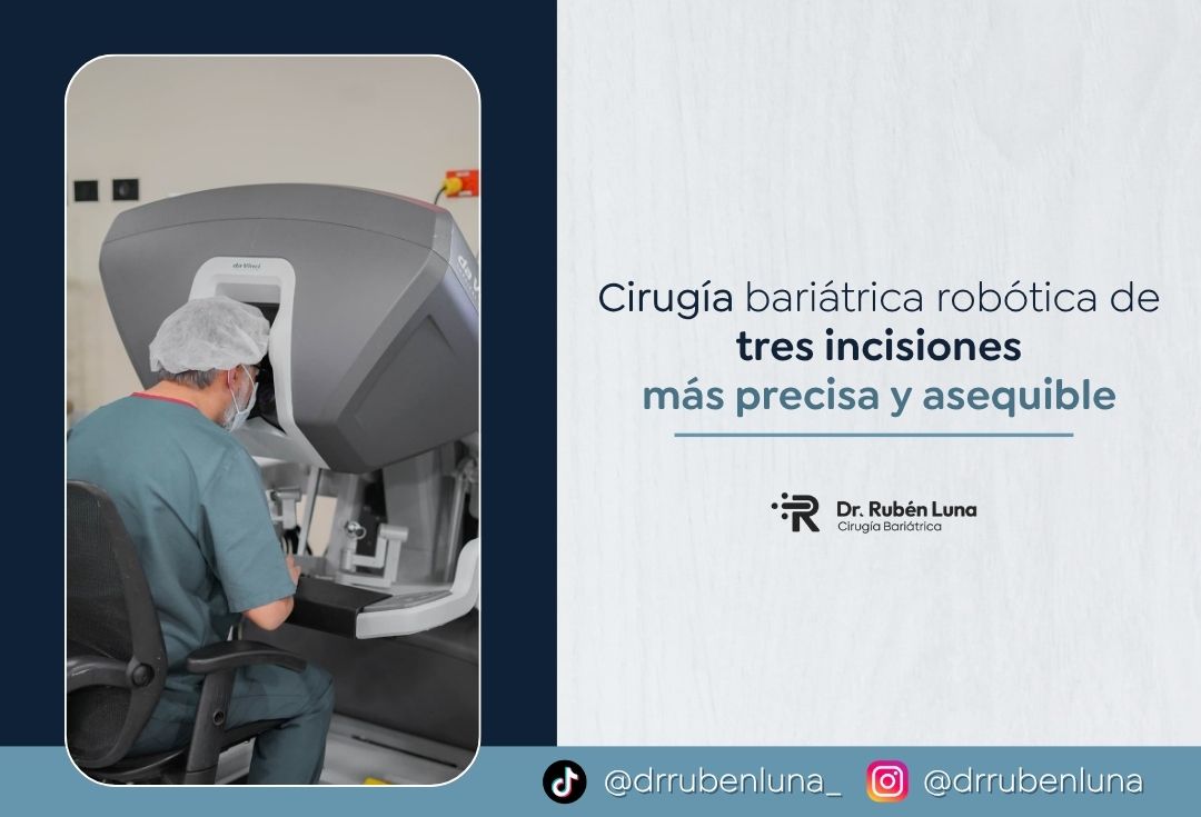 Cirugía bariátrica robótica de tres incisiones explicada por el Dr. Rubén Luna