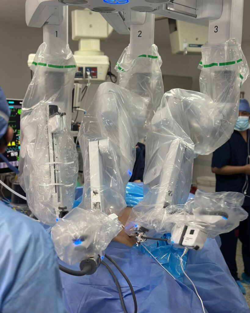 Cirujano bariátrico en Bogotá haciendo una cirugía bariátrica robótica con tres incisiones