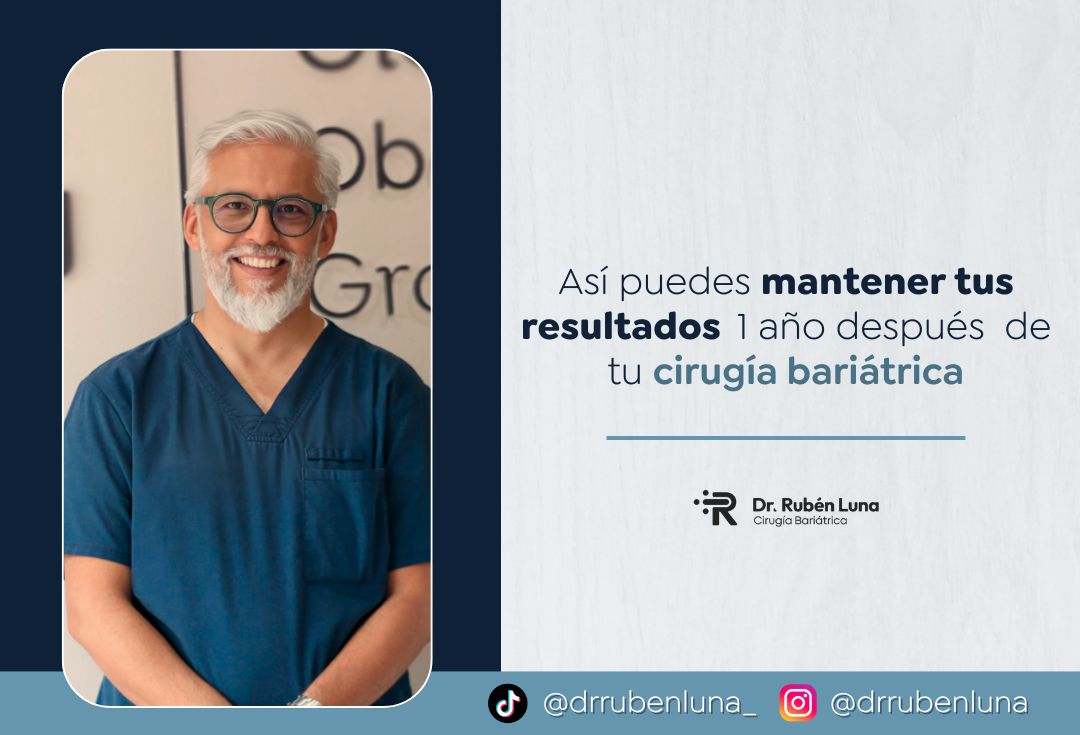 Dr. Rubén Luna cuenta cómo mantener los resultados de una cirugía bariátrica