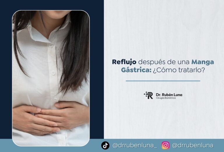 Reflujo después de una Manga Gástrica - Cómo tratarlo - Dr. Ruben Luna