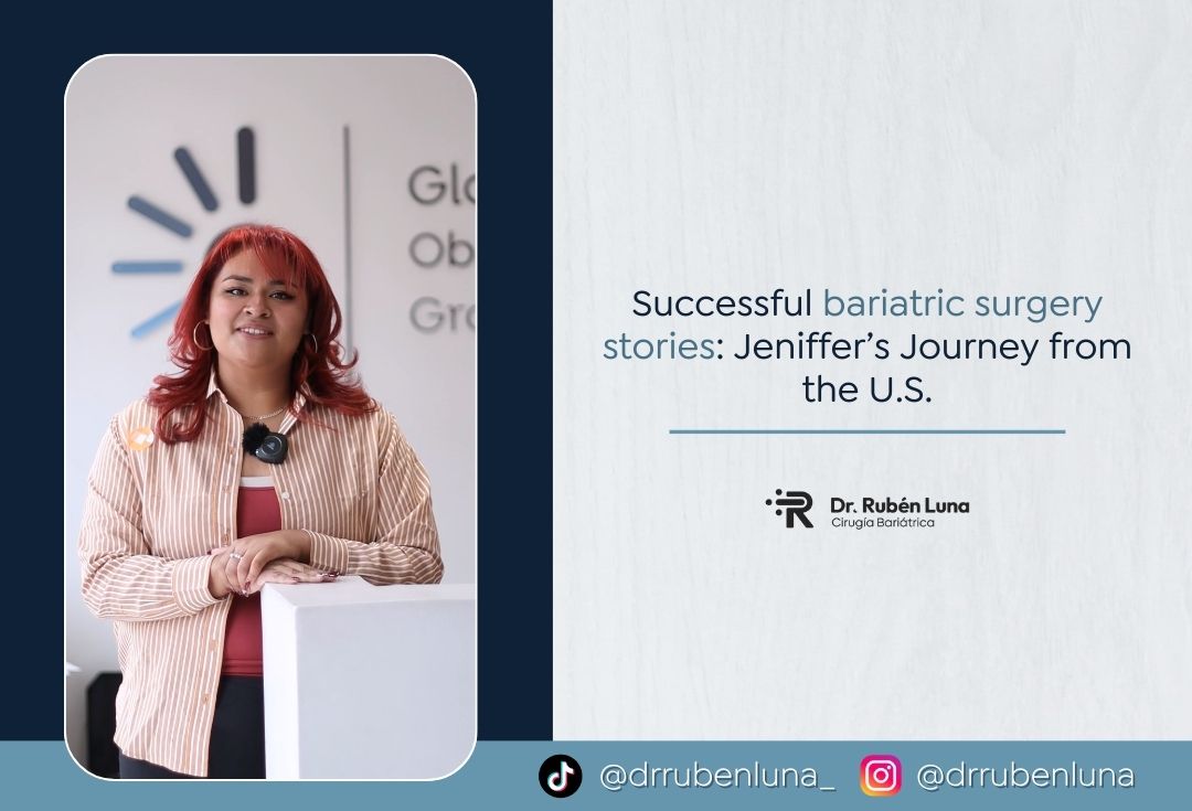 Successful bariatric surgery stories Jeniffer’s Journey from the U.S. - Dr. Rubén Luna