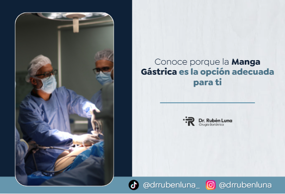 Conoce porque la manga gástrica es la mejor opción-Dr. Rubén Luna