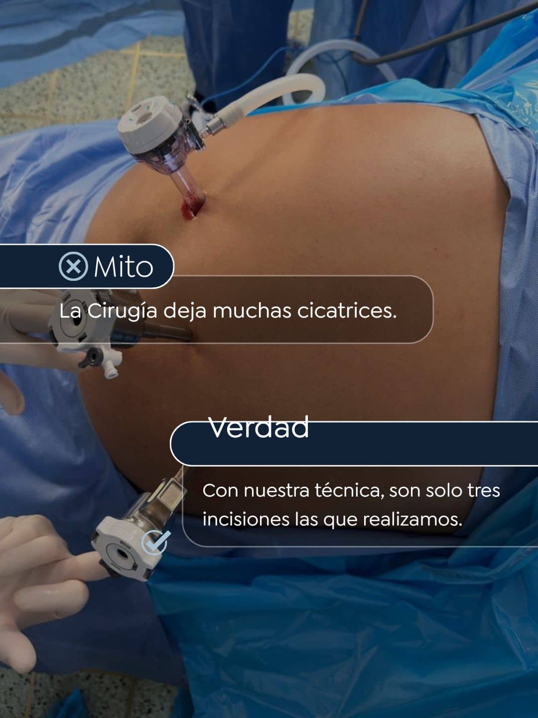Mitos y verdades de la cirugía bariátrica - Dr. Rubén Luna Bogotá, Colombia 5