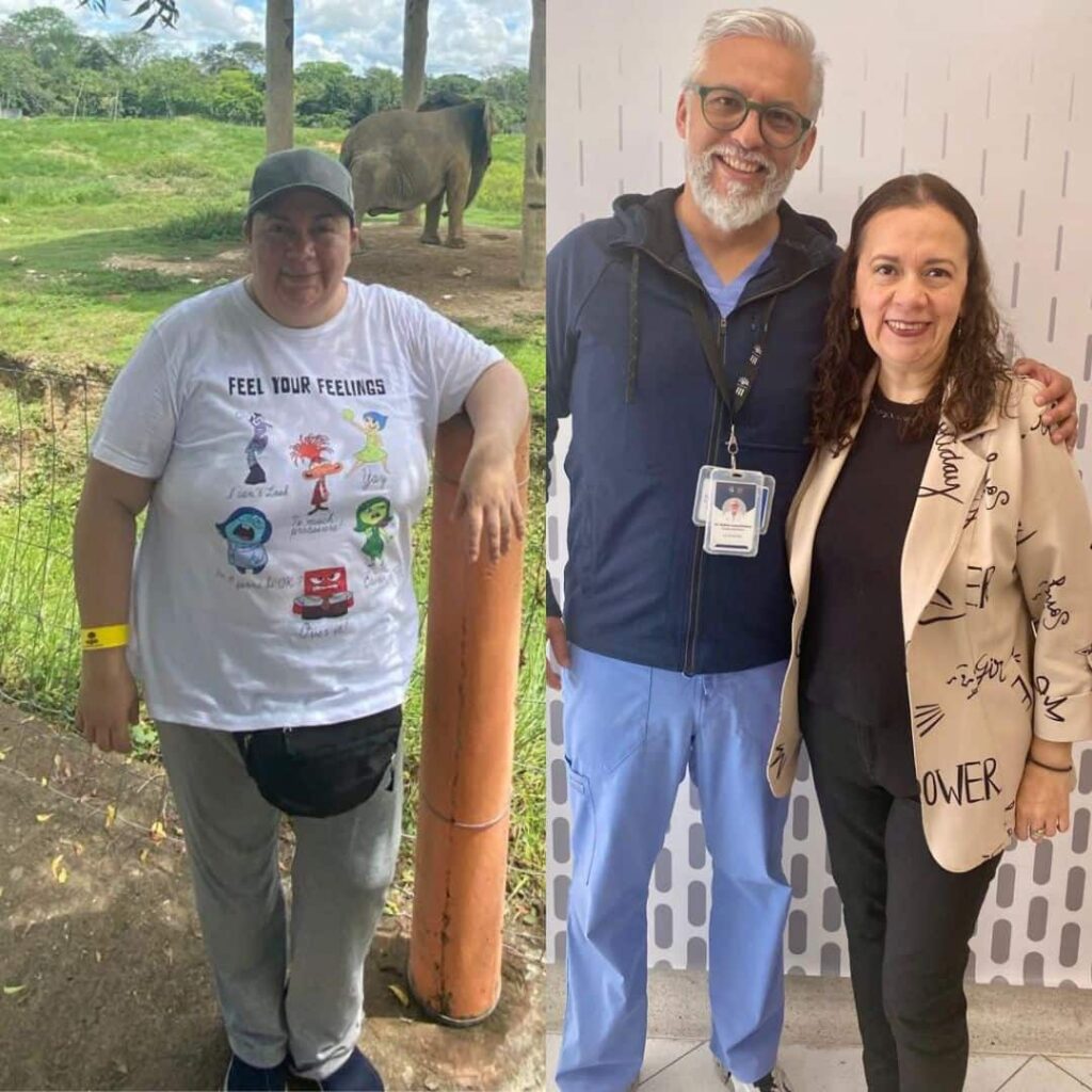 Antes y después de cirugía bariátrica en Bogotá con el Dr. Rubén Luna - 011125