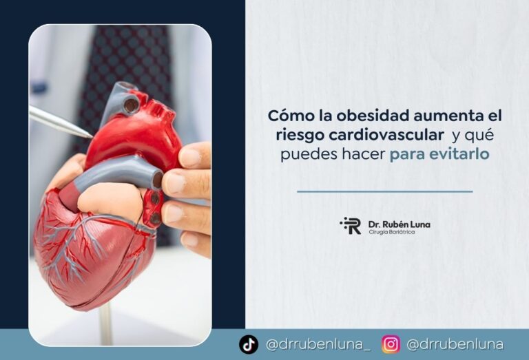 Obesidad y riesgo cardiovascular - Cirujano bariátrico Rubén Luna