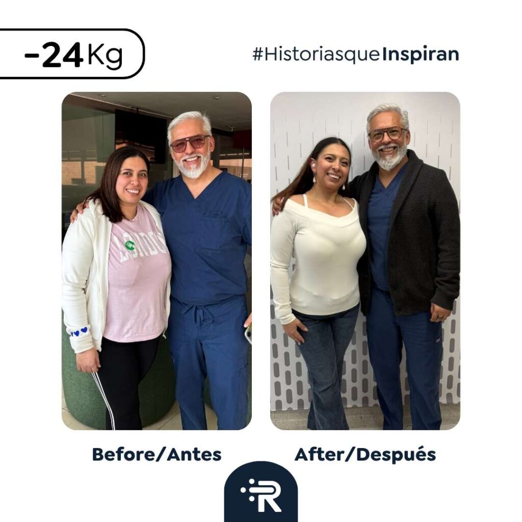 Cirugía bariátrica antes y después en Bogotá, Colombia - Dr. Rubén Luna 9