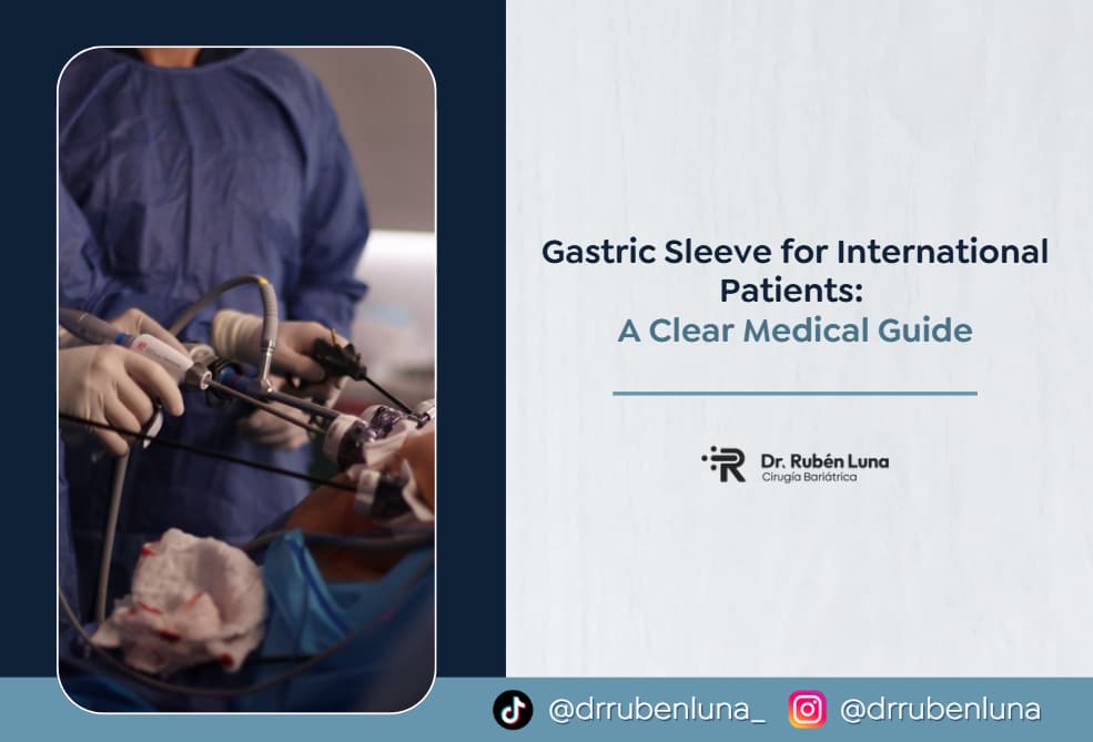 Gastric Sleeve-Dr. Rubén Luna