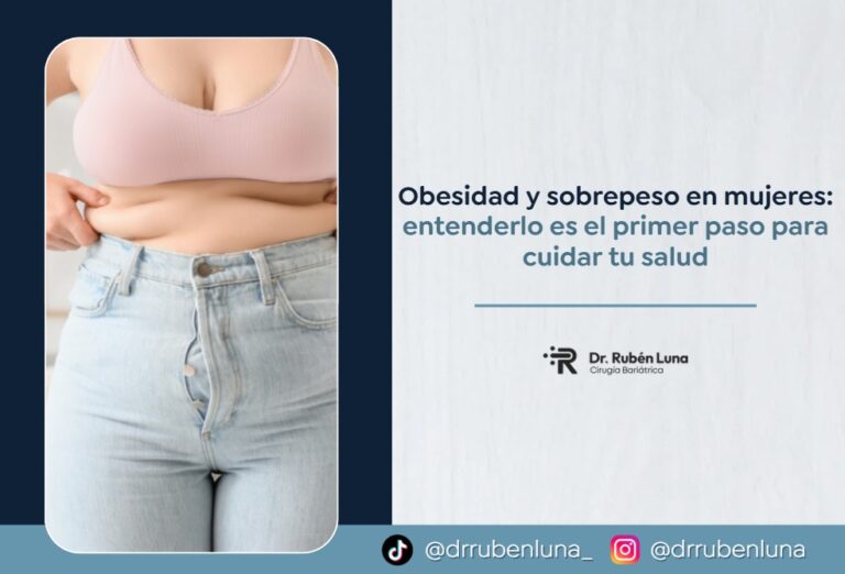Obesidad y sobrepeso en mujeres-Dr.Ruben Luna