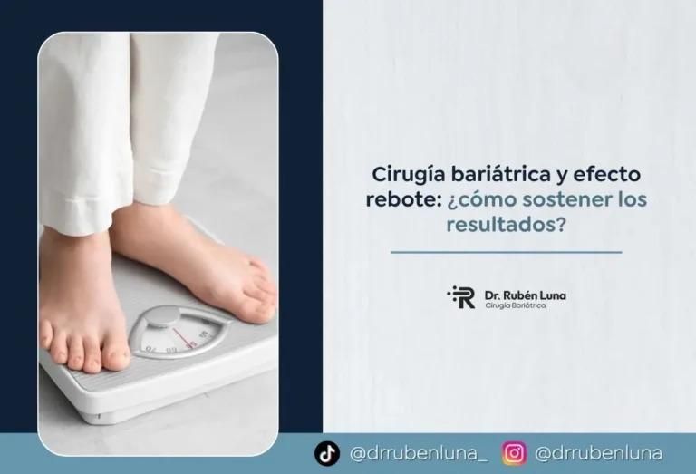 Cirugía bariátrica y efecto rebote cómo sostener los resultados - Dr Rubén Luna