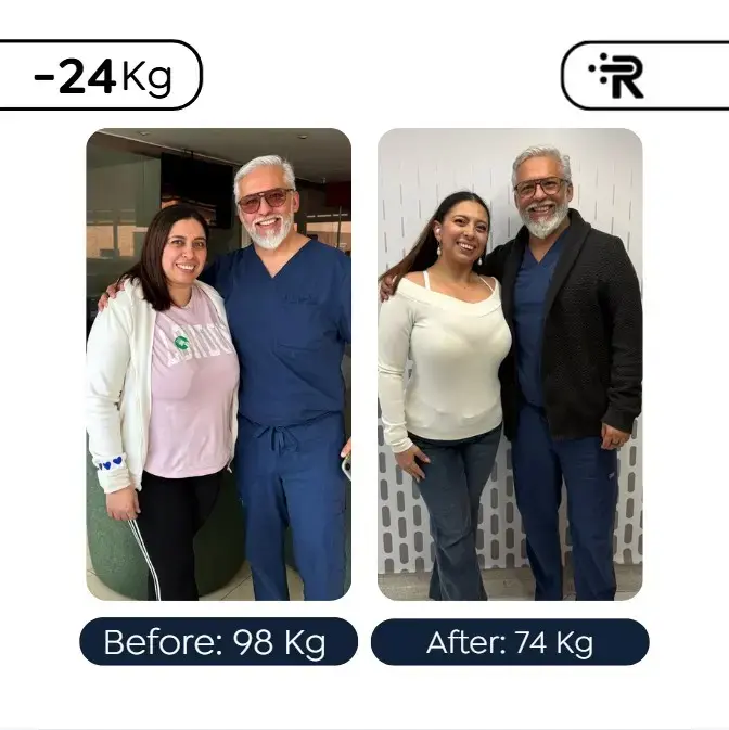 Me hice una manga gástrica y estoy embarazada-Dr. Ruben Luna- Cirujano Bariátrico