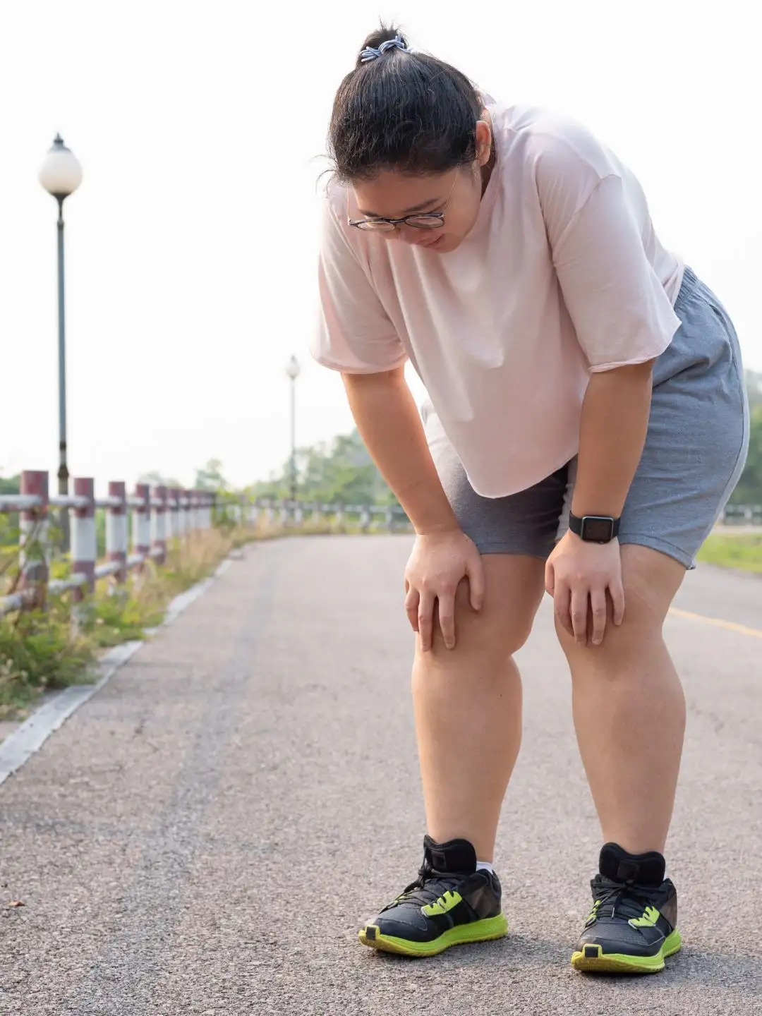 Síntomas de obesidad preclínica - Cansancio - Dr. Rubén Luna, cirujano bariátrico en Bogotá Colombia