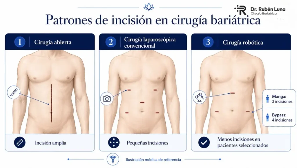 Incisiones de la cirugía bariátrica - Cuál cirugía bariátrica es menos invasiva - Dr. Rubén Luna - Bogotá, Colombia 2