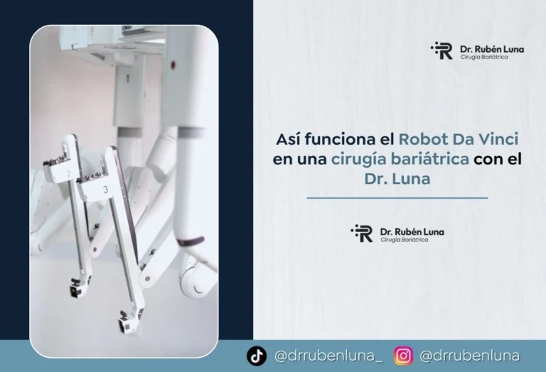 Así funciona el Robot Da Vinci en una cirugía bariátrica con el Dr. Luna - Dr Ruben Luna