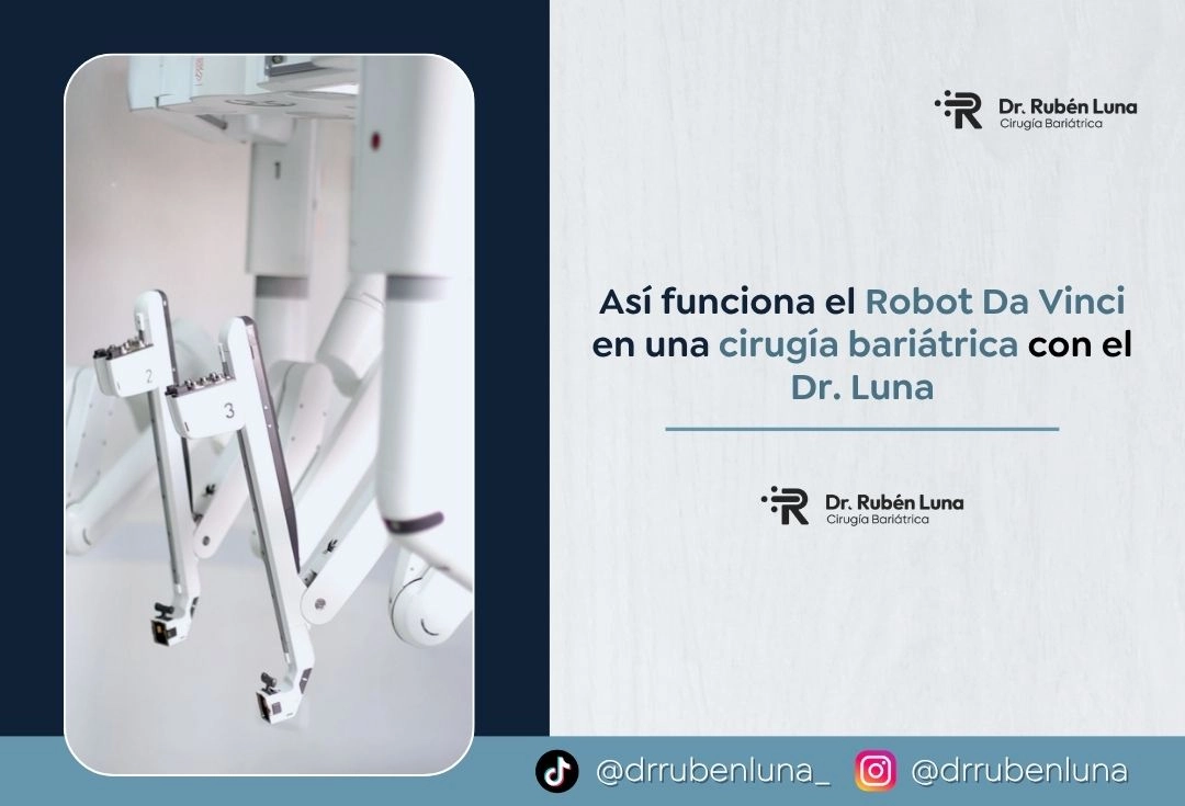 Así funciona el Robot Da Vinci en una cirugía bariátrica con el Dr. Luna - Dr Ruben Luna