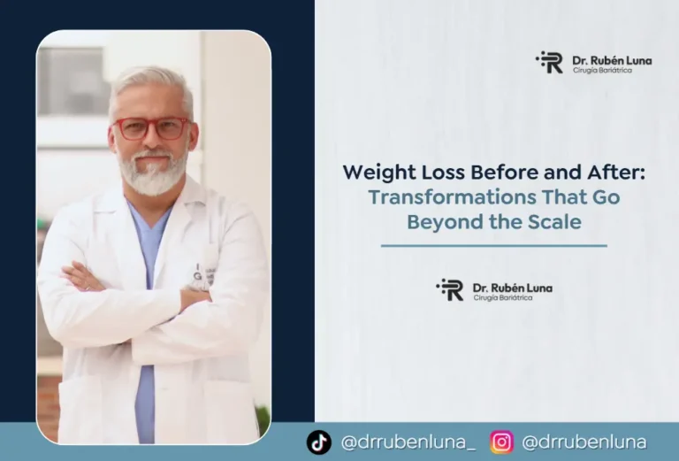 Weight loss Before and after- Dr. Ruben Luna