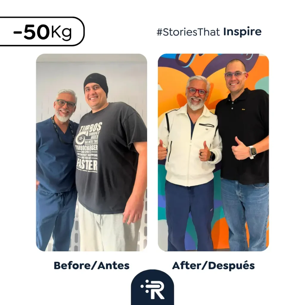 Before and After Bariatric Surgery Pic - Success Stories – Dr. Rubén Luna – Bogotá, Colombia