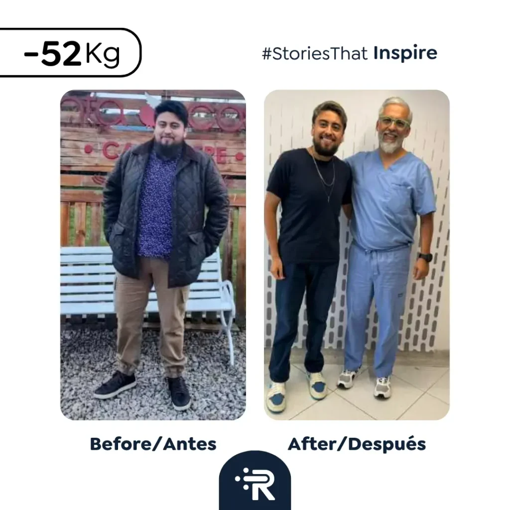 Before and After Bariatric Surgery Pics - Success Stories – Dr. Rubén Luna – Bogota