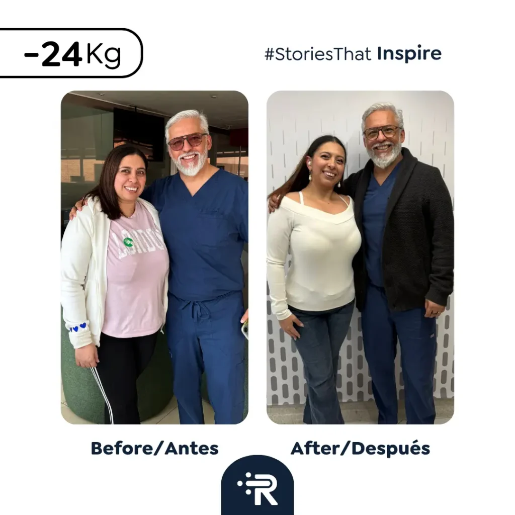 Before and After Bariatric Surgery - Success Stories – Dr. Rubén Luna – Colombia