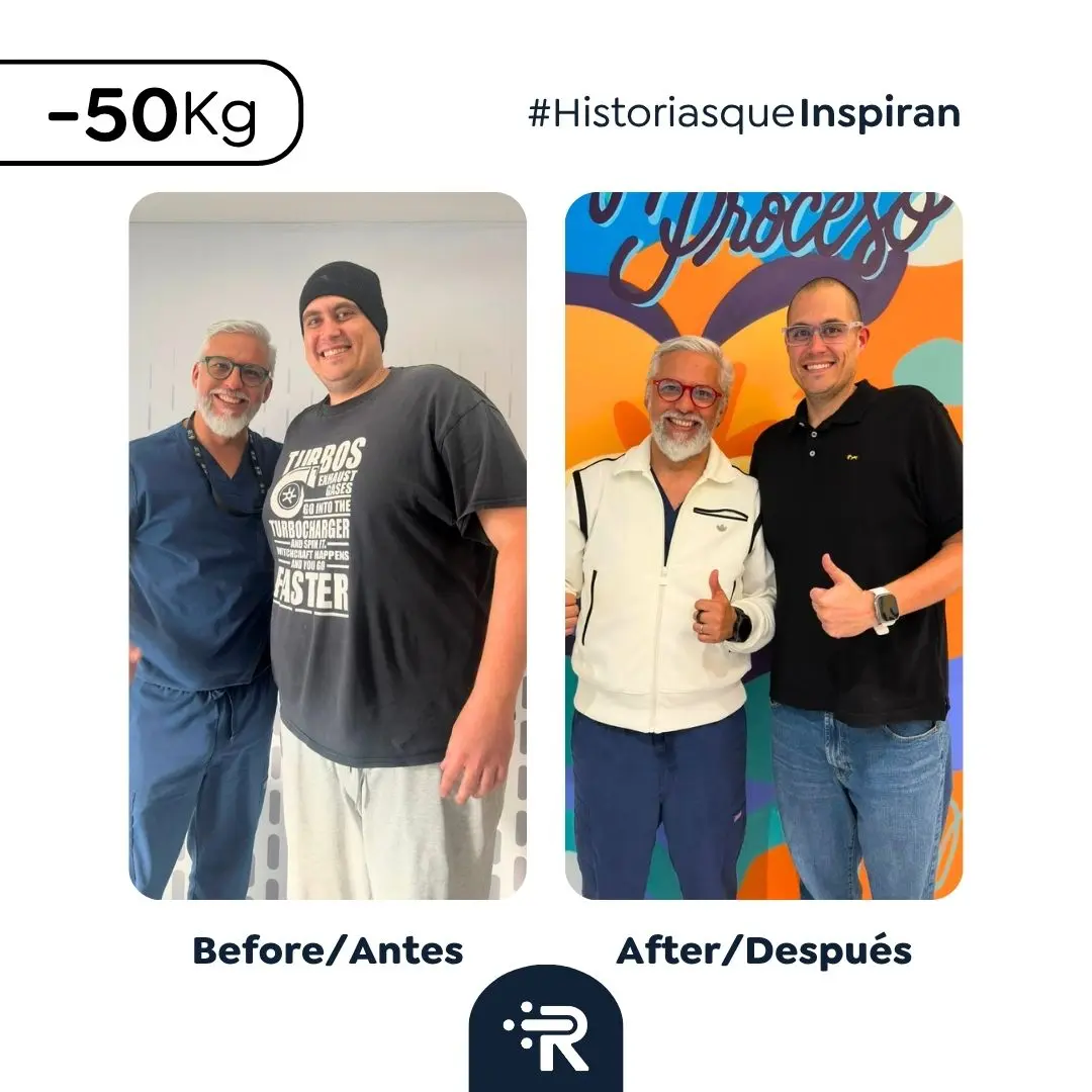 Cirugía bariátrica antes y después en Bogotá, Colombia - Dr. Rubén Luna - Manga gástrica - Bypass gástrico 03082026