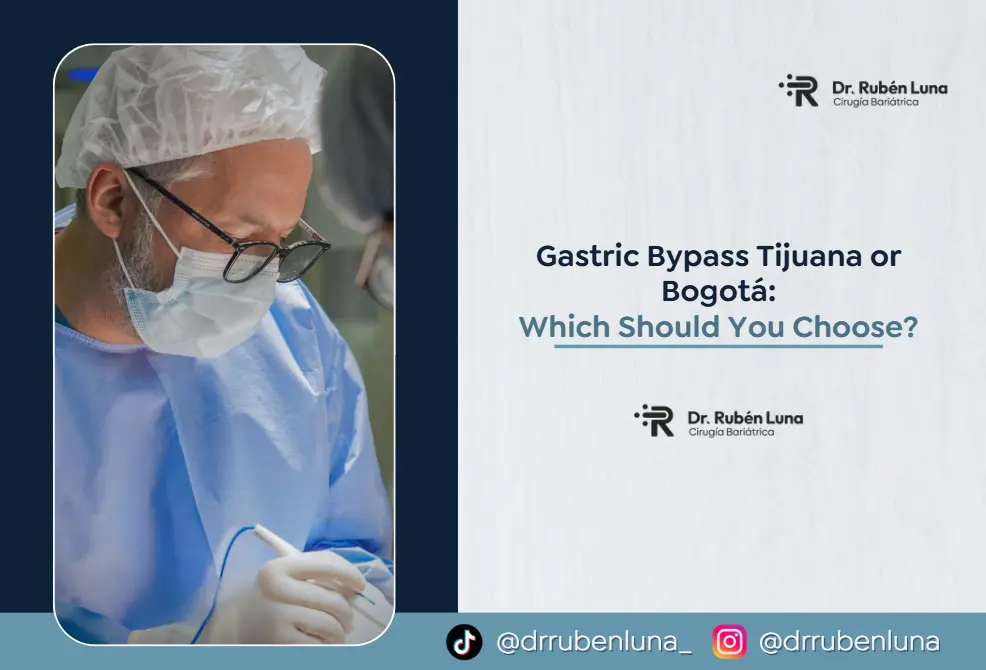 Gastric Bypass Tijuana or Bogotá- Dr. Ruben Luna