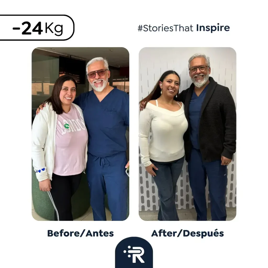 7 razones para decidir hacerte un Bypass Gástrico- Antes y después- Dr. Ruben Luna- Cirujano bariátrico en Bogotá