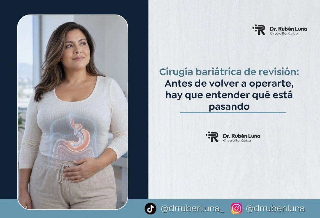 Cirugía bariátrica de revisión Antes de volver a operarte, hay que entender qué está pasando - Dr Rubén Luna