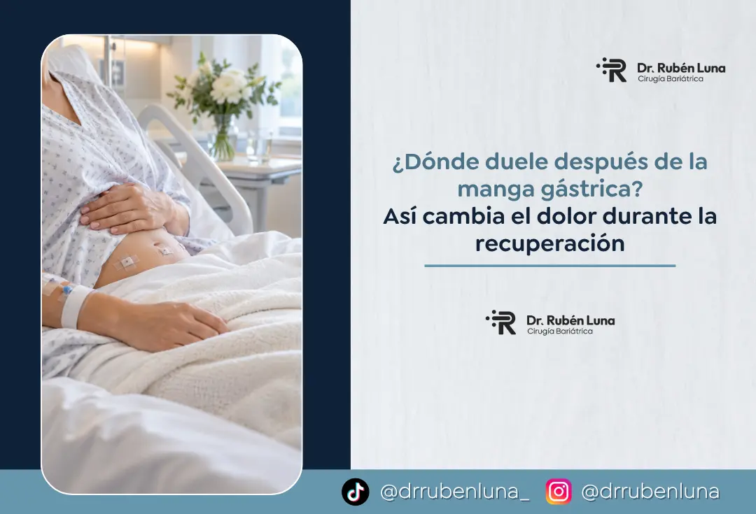 Dolor después de la manga gastrica - Dr. Rubén Luna - Bogotá, Colombia